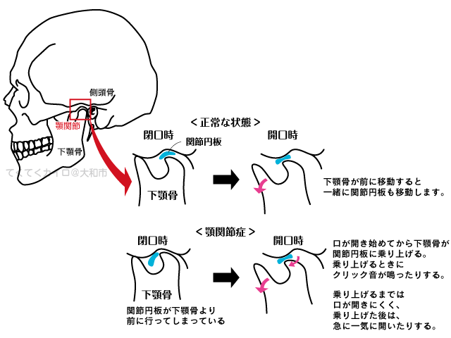 顎関節